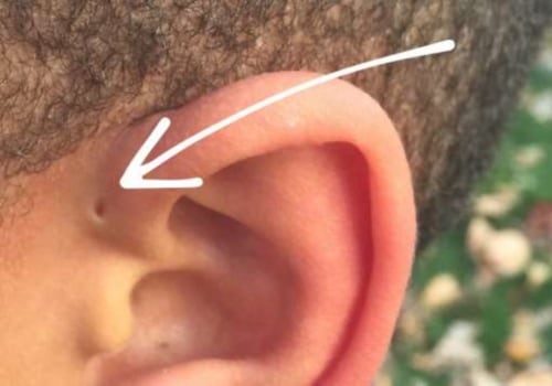 Τι κάνουν τα βαριά σκουλαρίκια στα αυτιά σας;